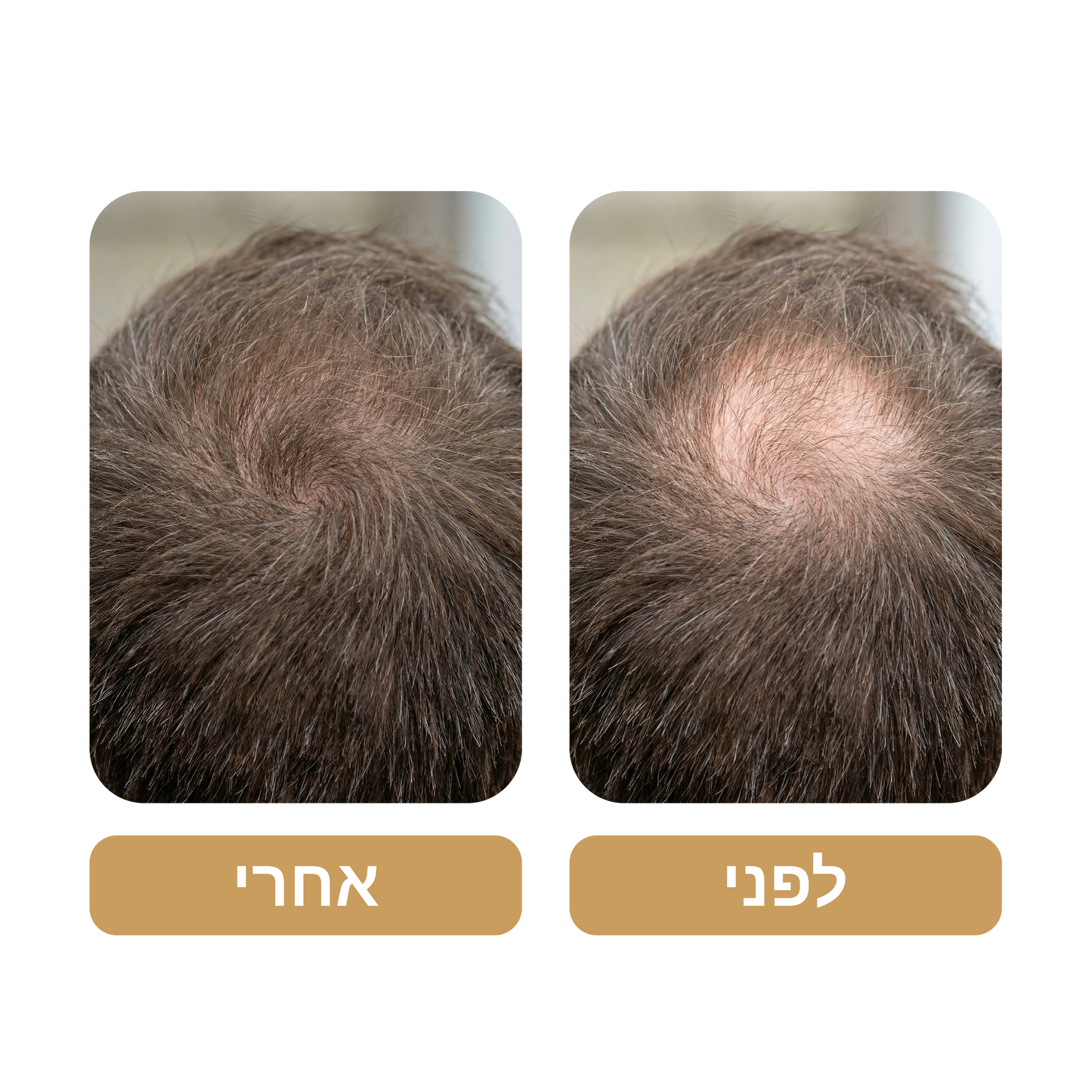 שמפו Venus Root Activator לגברים נגד נשירת שיער - צמיחת שיער מוגברת עם 4 חפיפות בשבוע בלבד*