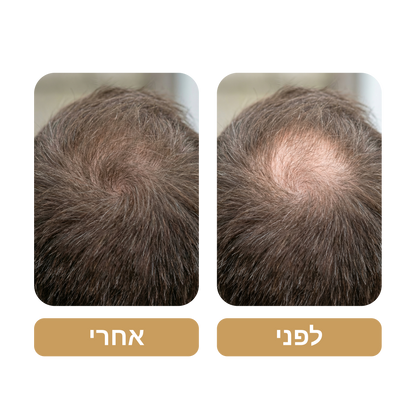 שמפו Venus Root Activator לגברים נגד נשירת שיער - צמיחת שיער מוגברת עם 4 חפיפות בשבוע בלבד*