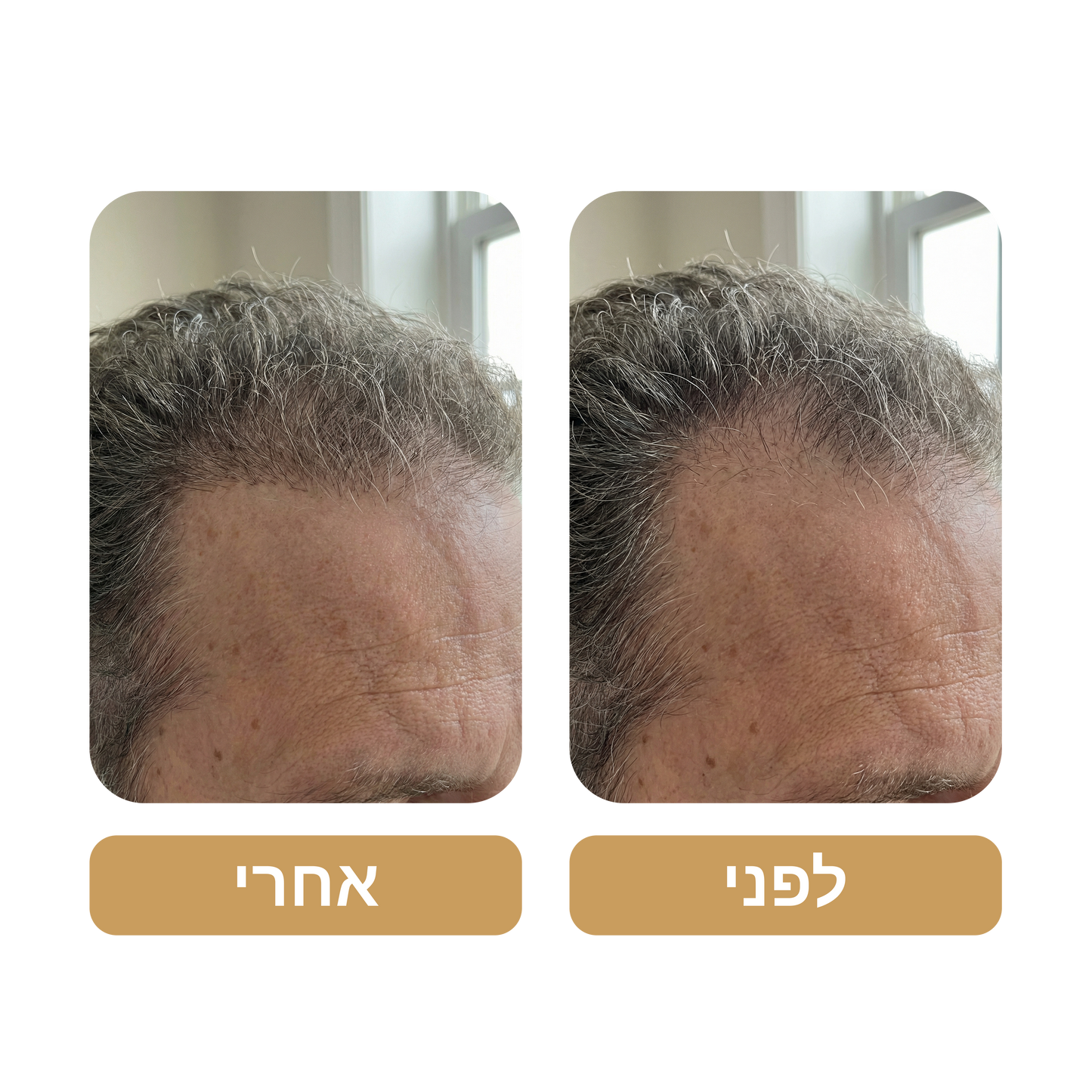 שמפו Venus Root Activator לגברים נגד נשירת שיער - צמיחת שיער מוגברת עם 4 חפיפות בשבוע בלבד*