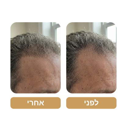 שמפו Venus Root Activator לגברים נגד נשירת שיער - צמיחת שיער מוגברת עם 4 חפיפות בשבוע בלבד*