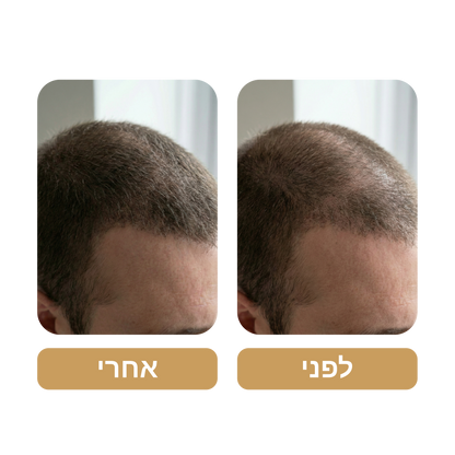 שמפו Venus Root Activator לגברים נגד נשירת שיער - צמיחת שיער מוגברת עם 4 חפיפות בשבוע בלבד*