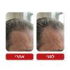 שמפו לצמיחת שיער - Venus Root Activator