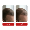 שמפו לצמיחת שיער - Venus Root Activator