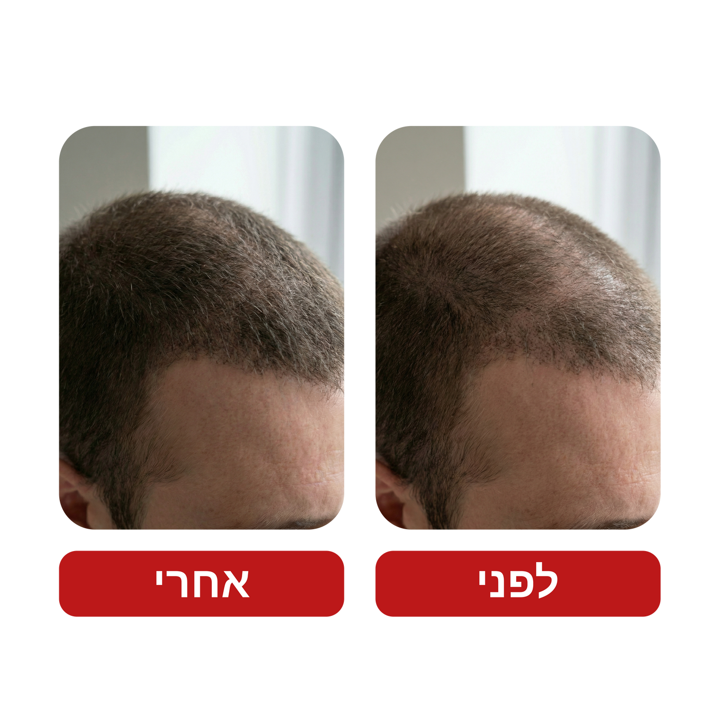 שמפו לצמיחת שיער