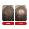 שמפו לצמיחת שיער - Venus Root Activator