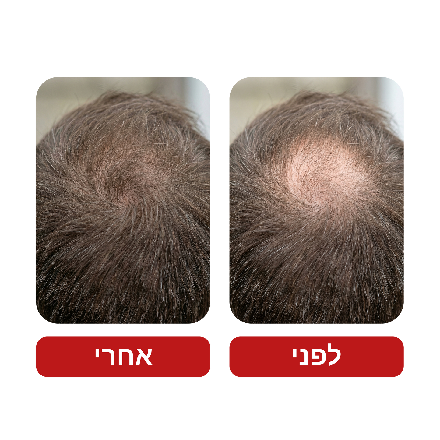 שמפו לצמיחת שיער